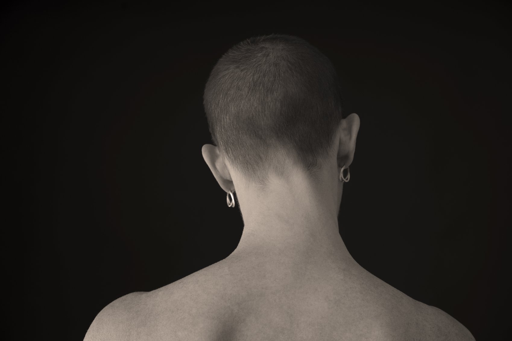 Bald Nude Woman With Cancer, Facing Away From The Camera